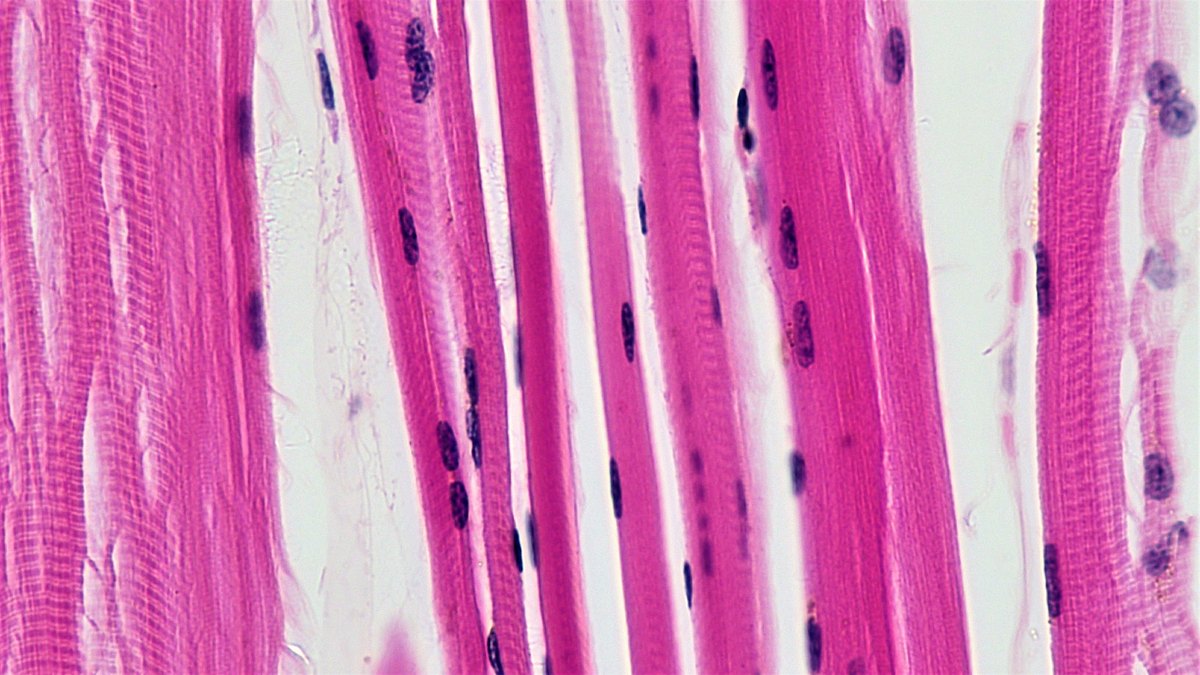 Skeletal muscle fibre under the microscope — the lean tissue that muscle-preservation research aims to spare during weight loss, a Panacea Bio Chem topic curated by Bogdan Dicoias